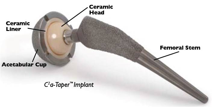 ceramic-joint